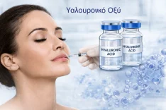 υαλουρονικό οξύ filler προσώπου